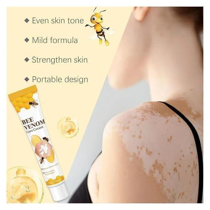 Bee Venom Vitigo Cream | Whitening, Brightening & Acne Scar Removal Formula for All Skin Types