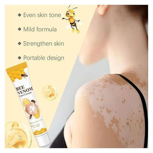 Bee Venom Vitigo Cream | Whitening, Brightening & Acne Scar Removal Formula for All Skin Types