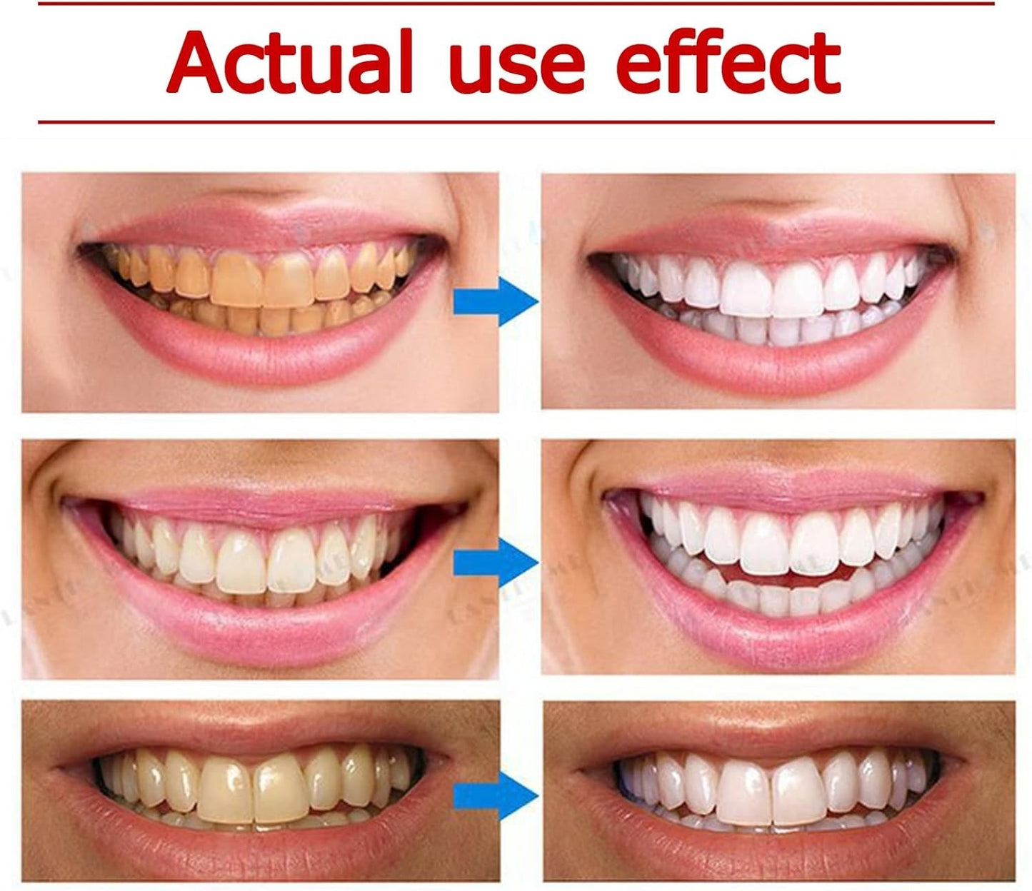 Yayashi SP-4 Ultra Whitening Toothpaste – 150ml